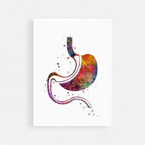 Gastric Sleeve Surgery Art Watercolor Print Laparoscopic Sleeve Gastrectomy Metabolic and Weight loss surgery