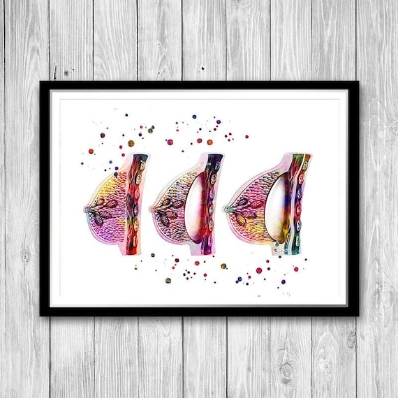 Female Breast Augmentation watercolor print, plastic surgeon gift, plastic surgery
