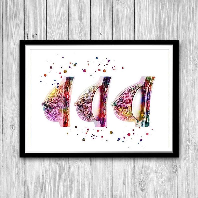 Female Breast Augmentation watercolor print, plastic surgeon gift, plastic surgery