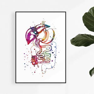 Duodenal Switch Watercolor Art Print, Bariatric Clinic Wall Decor, Weight Loss Surgery Artwork, Medical Poster