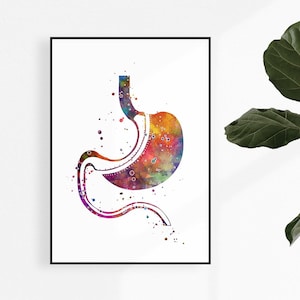Gastric Sleeve Surgery Art Watercolor Print Laparoscopic Sleeve Gastrectomy Metabolic and Weight loss surgery