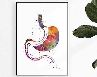 Gastric Sleeve Surgery Art Watercolor Print Laparoscopic Sleeve Gastrectomy Metabolic and Weight loss surgery