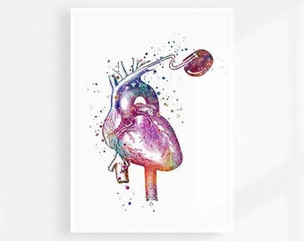 Herzschrittmacher Herzstimulator Aquarell Kunstdruck