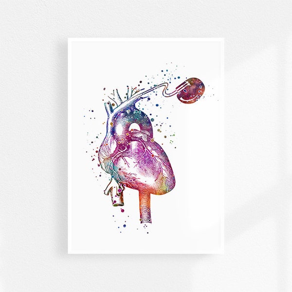 Heart pacemaker cardio stimulator watercolor art print