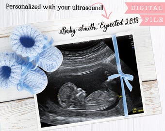 its a boy announcement