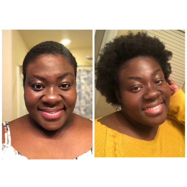 Fast Hair Growth Shea Butter for Black Woman With Curly Etsy