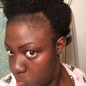 photo of mom that has thin edges due to postpartum hair loss.