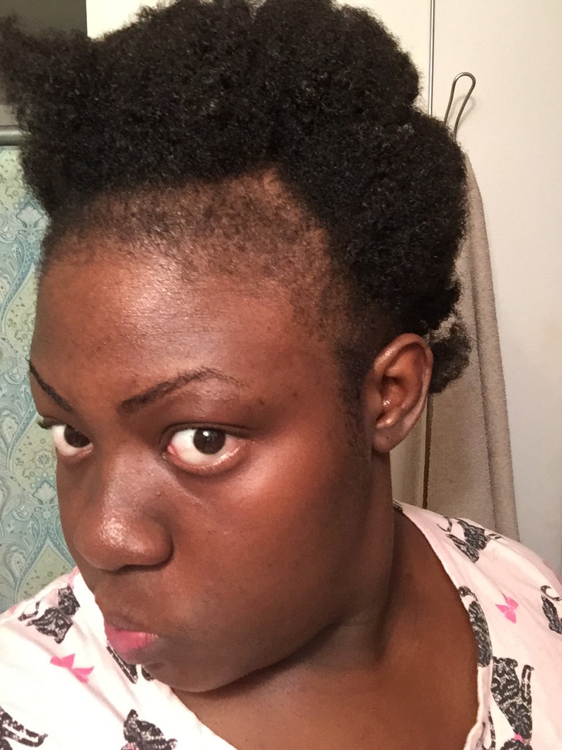 photo of mom that has thin edges due to postpartum hair loss.