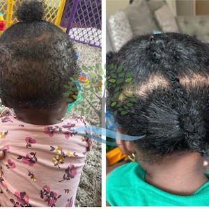 Best Hair Growth Shea Butter Cream for Dry, damaged hair.