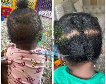 Best Hair Growth Shea Butter Cream for Dry, damaged hair.