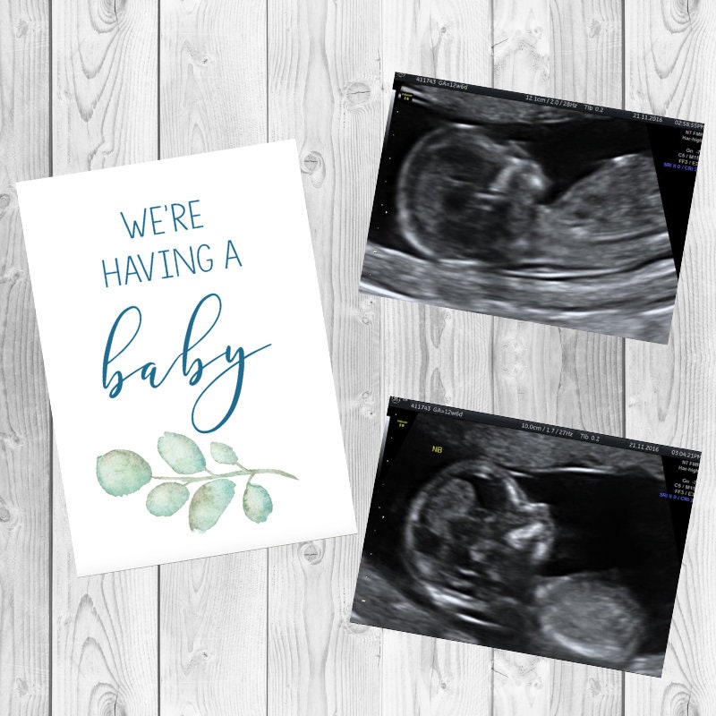 Floral Leafy Green Pregnancy Milestone Cards / Pregnancy Photo Etsy