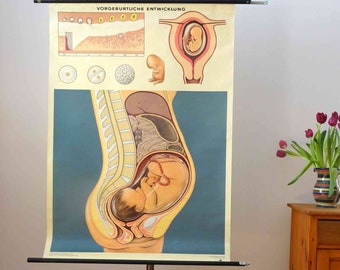 Puede incluir: Un gráfico médico vintage en un soporte que representa una ilustración detallada de la anatomía de una mujer embarazada con el texto "Vorgeburtiche Entwicklung" en la parte superior. El gráfico está en un suelo de madera con un pequeño armario de madera y flores rosas en un jarrón en el fondo.