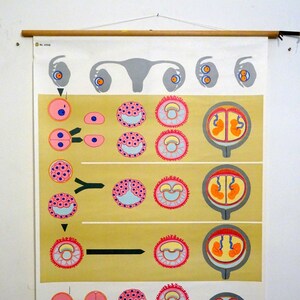 carte scolaire vintage | Développement de jumeaux identiques I/ovulation/médicament, années 1990, vintage rétro, tableau mural, tableau scolaire