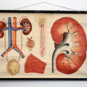 Schulwandkarte | Nieren / Körper / Medizin, 50er, retro vintage, deko, Poster, Plakat, Druck, Leinwand, Rollkarte, Lehrkarte