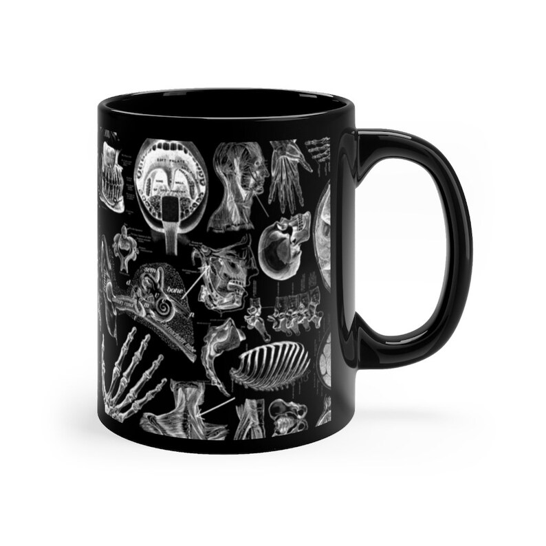 Human Anatomy White Print on Black Mug 11oz - Etsy
