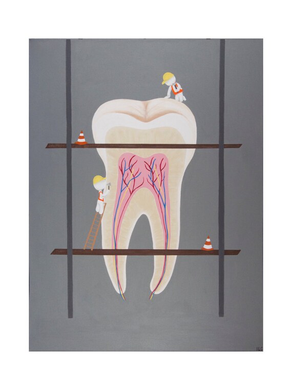 Dental Acrylic Molar Root Canal Canvas Print