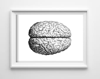 Retro Anatomical Brain Poster Retro Poster, Retro Wall Art, Human Anatomy Print, Medical Art #646