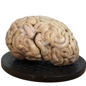 May include: A realistic model of a human brain, showcasing the intricate folds and textures of the cerebrum. The brain is a pale, fleshy color with subtle red veins, resting on a black, circular base. The image is set against a plain white background.