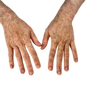 Alter Handprothetik - alter Mensch - Silikonprothetik - Halloween Look - Aging - SFX Make-up