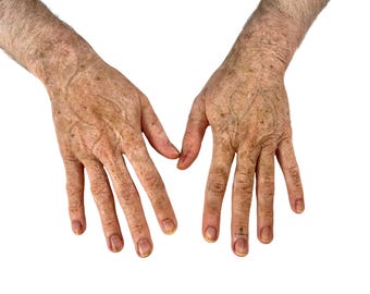 Old age hand prosthetics - old person - Silicone prosthetic - Halloween look - Aging - SFX make-up