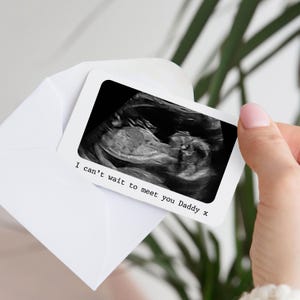 Carte portefeuille en métal personnalisée avec photo Baby Scan | Cadeau pour futur papa | Cadeau pour future maman | Faire-part souvenir Baby Scan | Fête des pères