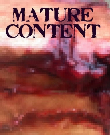 MATURE - Teratoma Hanging - Gory Fleshy Mass With Eyes, Ears and Teeth