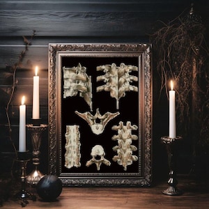 Vertebral bones, The structure of the vertebral Cross Stitch Pattern, Anatomical, Anatomy, Medical Cross Stitch, medical science