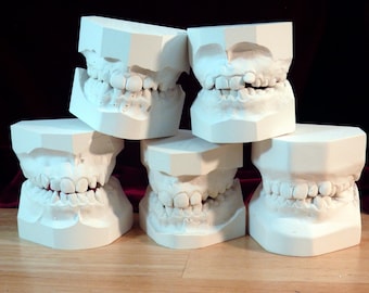 Vintage Juvenile Plaster Dental Casts 1 set.  (teeth bones medical orthodontist oddities curiosities curio halloween goth creepy gross)