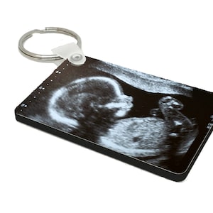 Baby Scan Foto Schlüsselanhänger Individuell Jedes Bild Schlüsselbund Doppelseitiger Druck