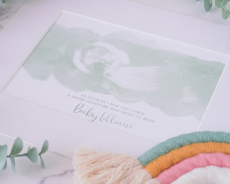 Watercolour Ultrasound Baby Scan Art Print Watercolour | Etsy