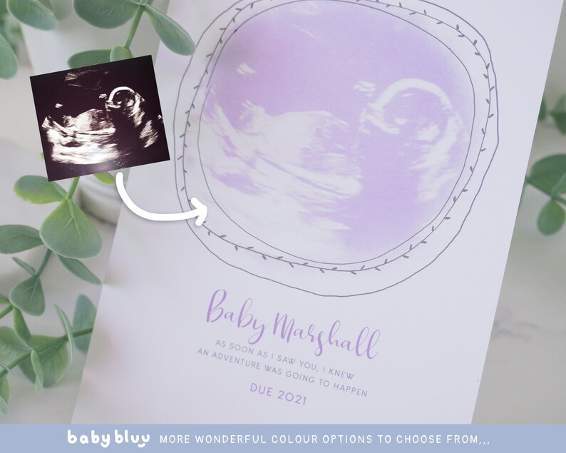 Ultrasound Keepsake Baby Scan Keepsake New Mum Gift Baby Etsy UK