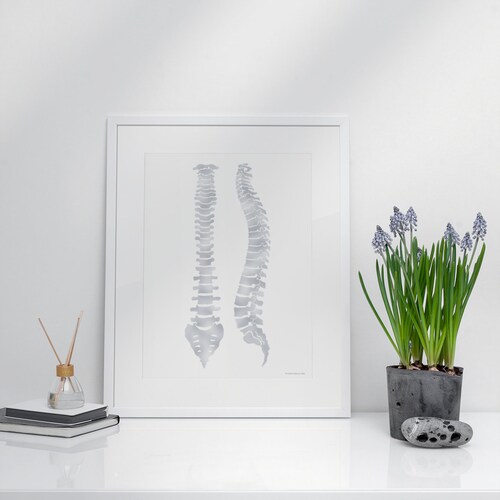 Spine Poster Chiropractic Chiropractor Chiropractic Office Etsy
