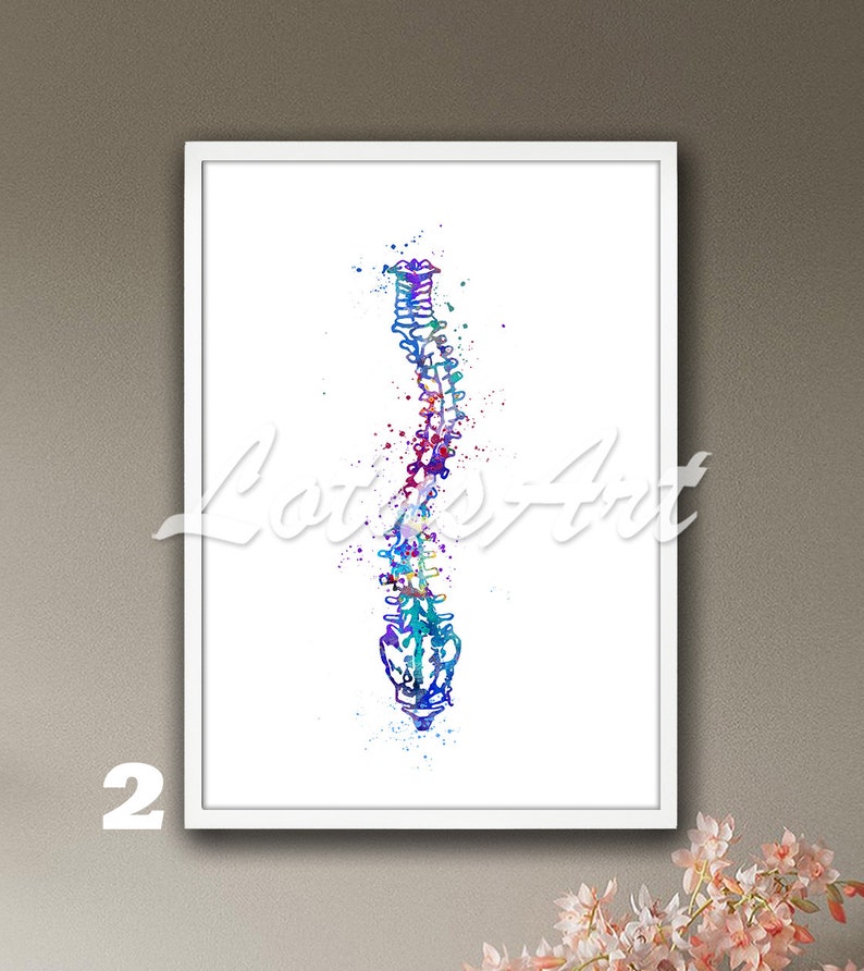 Spinal Drawing Color Scoliosis Spine Watercolor Print: Framed Anatomy Poster - Etsy