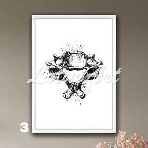 Cervical Vertebrae Anatomy Framed Wall Art Watercolor Print Medical ...