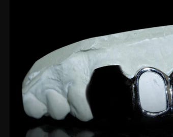 Grillz for Carl Milbourne