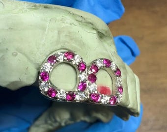 Custom Grillz- Dual Stone Setting