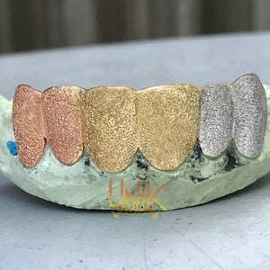 Pu&ograve; includere: Primo piano di un set di grillz dorati, oro rosa e argento. I grillz sono realizzati in metallo e hanno una superficie testurizzata. I grillz sono posizionati in uno stampo.