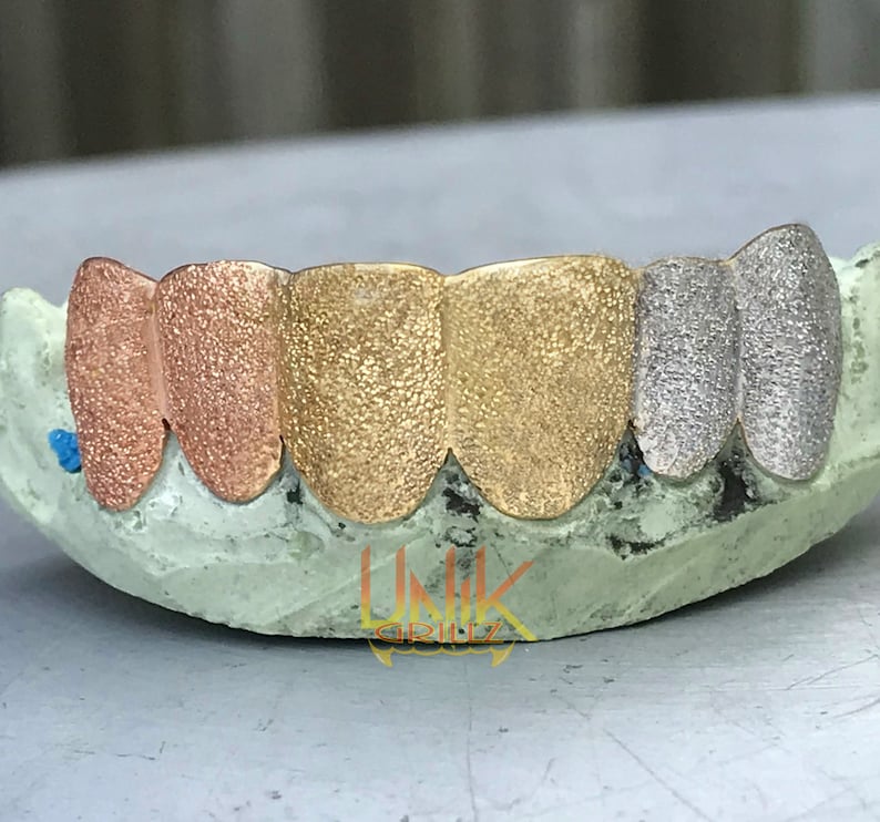 Pu&ograve; includere: Primo piano di un set di grillz dorati, oro rosa e argento. I grillz sono realizzati in metallo e hanno una superficie testurizzata. I grillz sono posizionati in uno stampo.