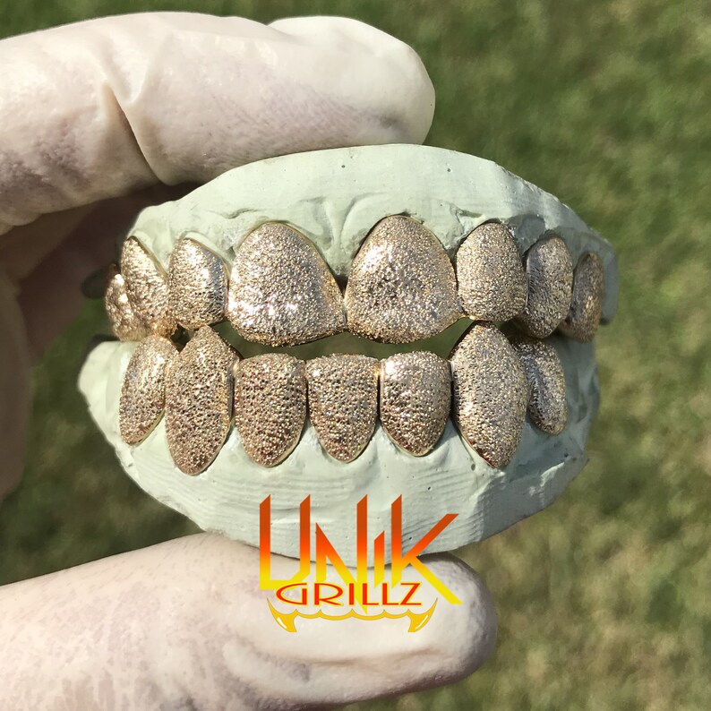 Custom Grillz with Full Diamond Dust Etsy