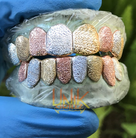 Custom Grillz with Tri color Diamond Dust