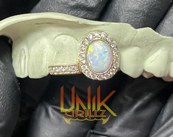 Custom Grillz- Opal Queen