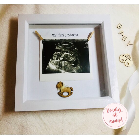 Baby Scan Photo Frame First My Image 0