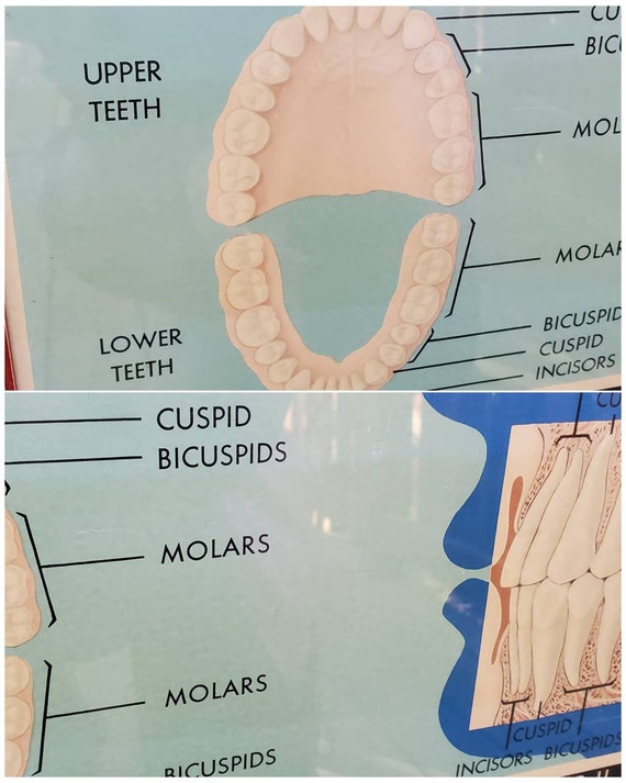 Vintage Dentist Teeth Medical Poster Advertising - image 4