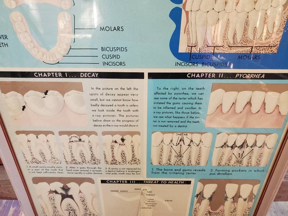 Vintage Dentist Teeth Medical Poster Advertising - image 6