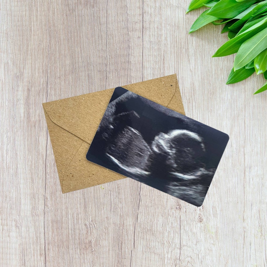 Baby Scan Keepsake Wallet Card Plastic ID Card New Baby Etsy Australia