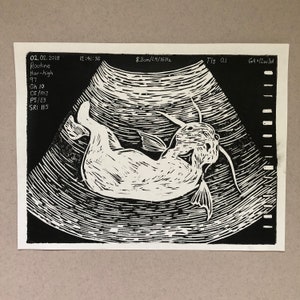 Ultrasound Parasite Linocut Print - Black and White