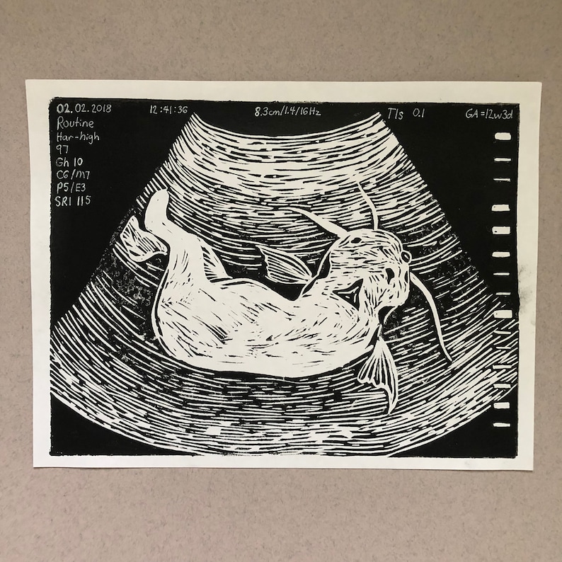 Ultrasound Parasite Linocut Print Black and White