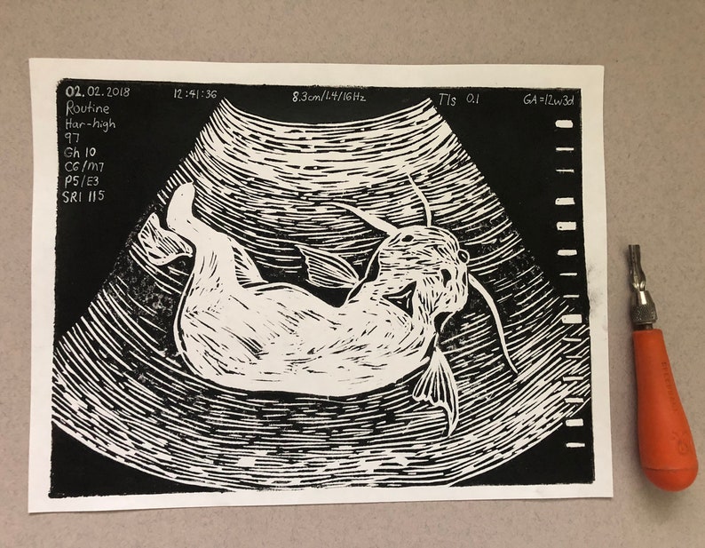 Ultrasound Parasite Linocut Print Black and White