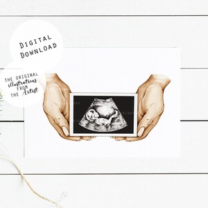 Escaneo de bebé Ultrasonido Acuarela Imprimir Embarazo Primer escaneo personalizado del bebé Regalo de las nuevas mamás para ser un recuerdo del embarazo Día de las Madres de la Madre