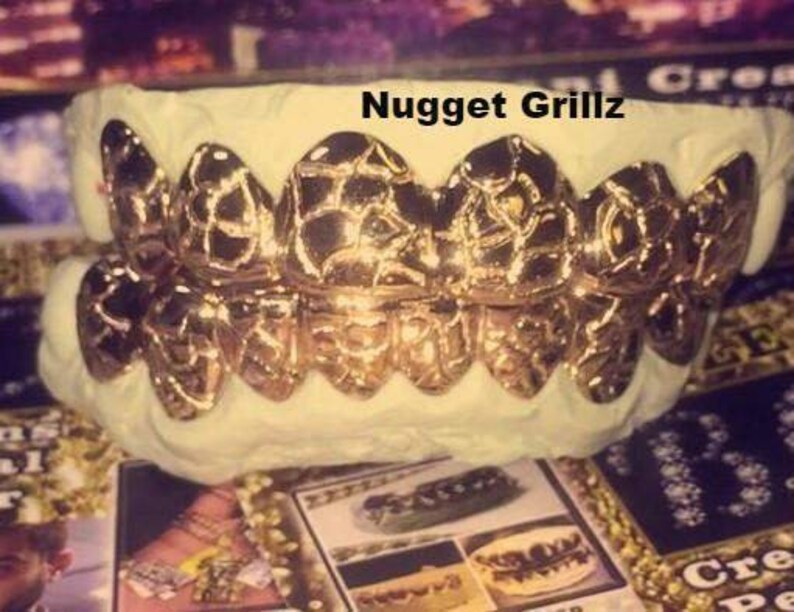 5 Teeth 10k Gold Custom Grillz Top